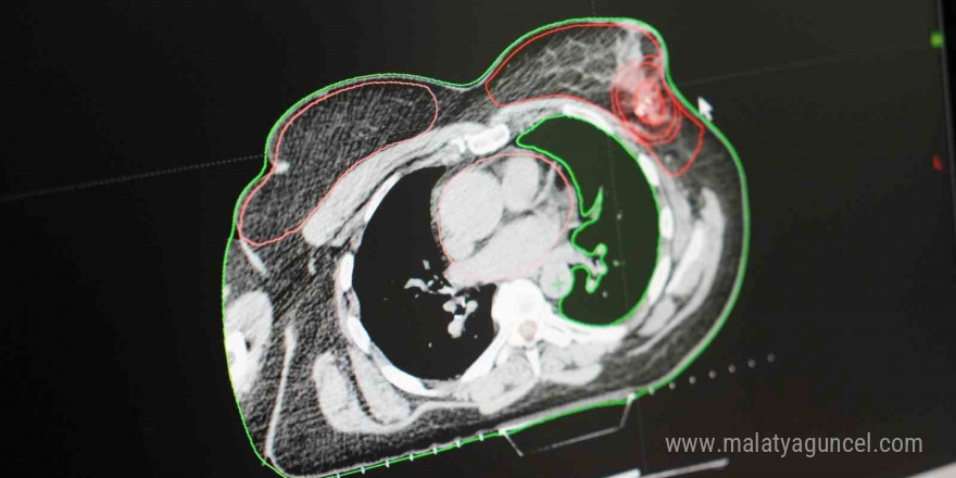 ’Meme kanseri’, tedavisi olan ve iyileşebilir bir hastalık türü